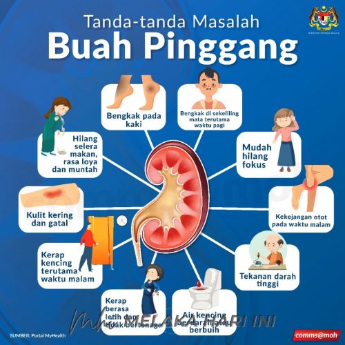 Buah pinggang