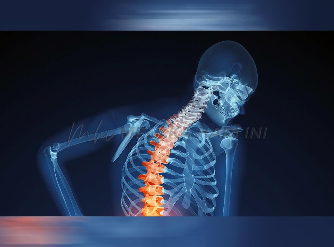 Wanita, kanak-kanak berisiko tinggi hidap osteoporosis