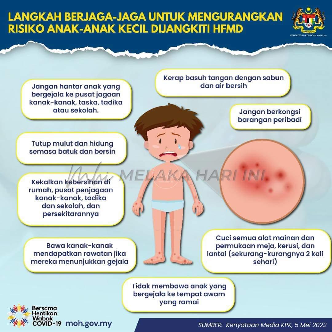 Kes HFMD di N. Sembilan meningkat 25 kali ganda