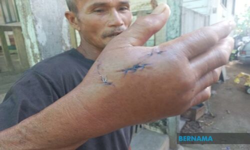 Warga emas cedera digigit buaya ketika mengambil wuduk