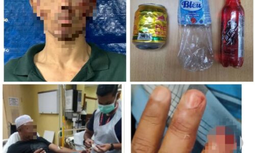 Polis putus sebahagian jari digigit penagih dadah