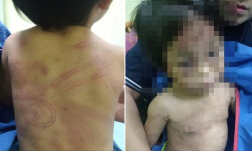 Suspek dera kanak-kanak perempuan miliki 13 rekod jenayah