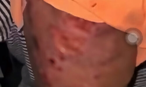 JKM Johor Bahru kesan waris kanak-kanak tujuh tahun mangsa dera