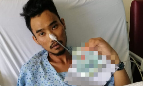 Amal pemakanan sihat, suplemen tambahan berjuang lawan kanser