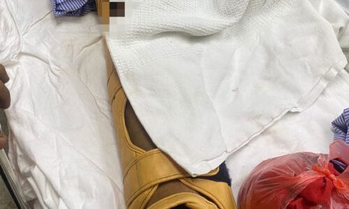 Insiden cari udang galah, warga emas cedera digigit buaya