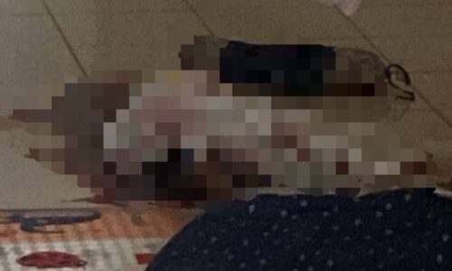 Polis sahkan kematian bayi akibat luka dikelar di bahagian leher