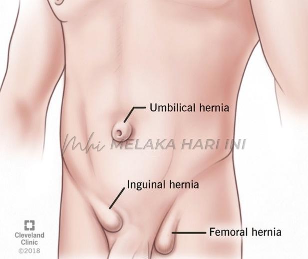 Whatsapp image 2025 06 06 at 12.31.12