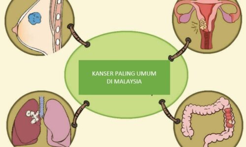MITOS DAN FAKTA TENTANG KANSER: APA PERLU ANDA FAHAMI?