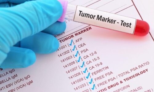 APA ITU PENANDA KANSER (TUMOUR MARKER)?