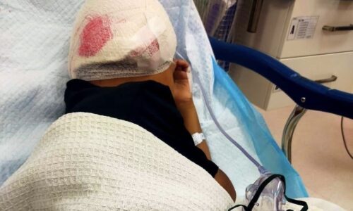 KANAK-KANAK LIMA TAHUN CEDERA DISERANG ANJING