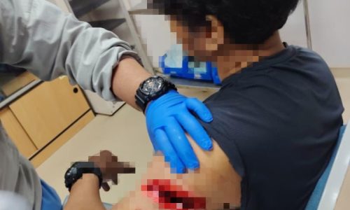 ANGGOTA POLIS PARAH DILIBAS PARANG, TIGA PENJENAYAH GENG DT TUMPAS DITEMBAK